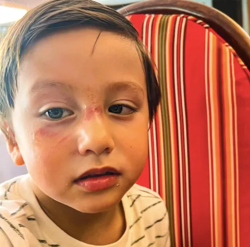 OH NO! Korina Sanchez’s son in minor accident