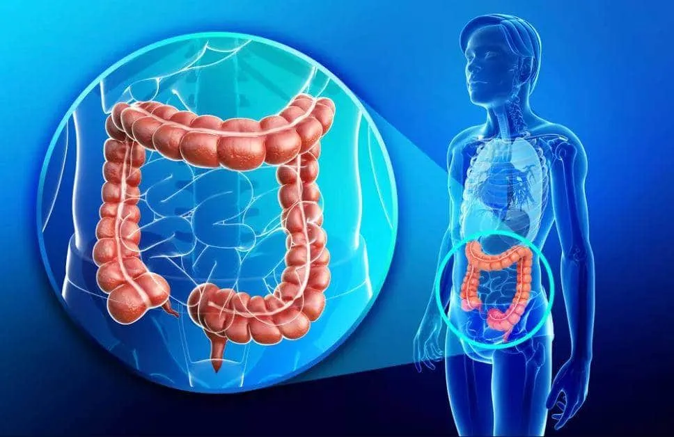 Caring for your colon