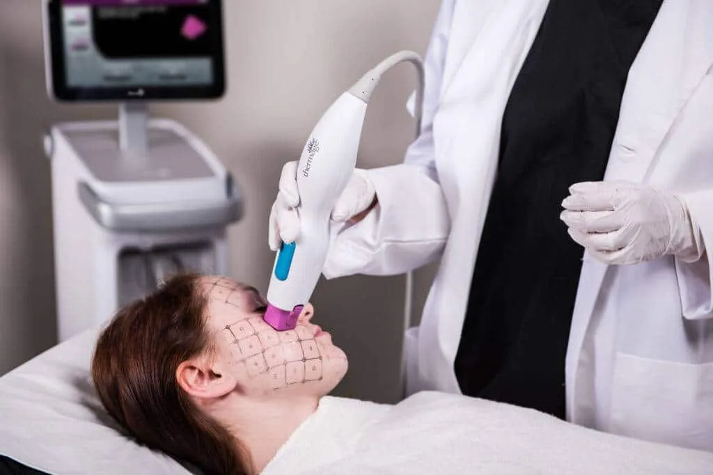 Ulthera, Thermage, or both?