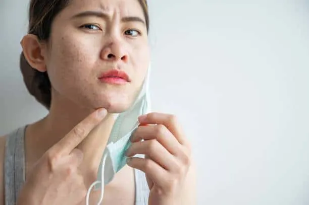 What’s causing your breakouts?